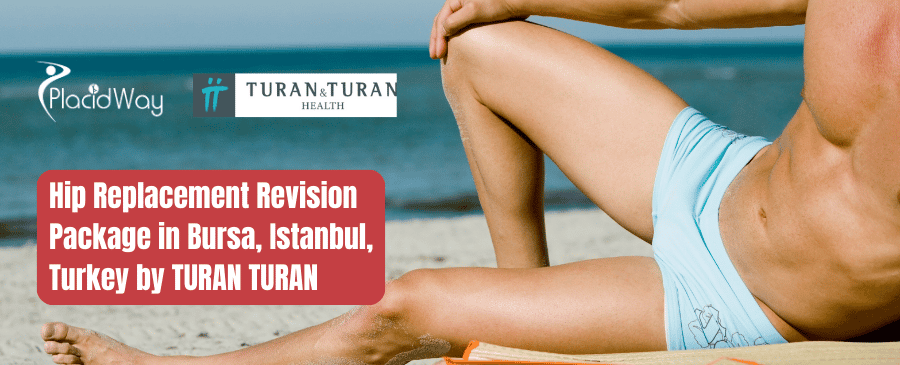 حزمة مراجعة استبدال مفصل الورك في توران توران في بورصة وإسطنبول وتركيا