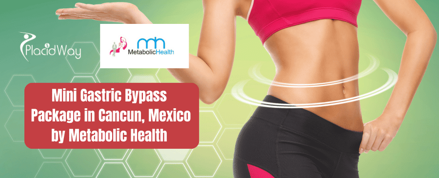 Paquete Mini Bypass Gástrico de Salud Metabólica en Cancún, México