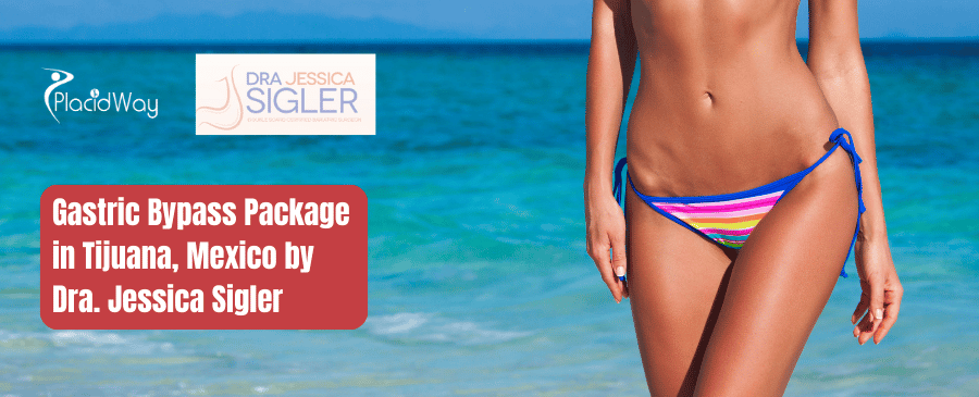 Paquete de Bypass Gástrico en Tijuana, México Dra. Jessica Sigler