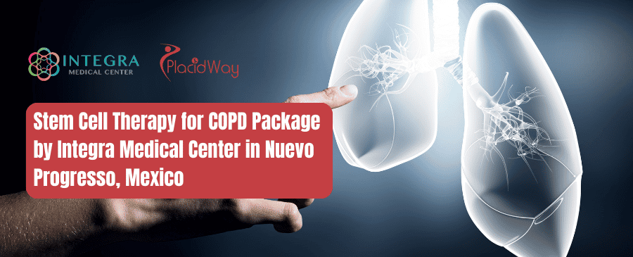 Paquete de terapia con células madre para EPOC del Centro Médico Integra en Nuevo Progreso, México