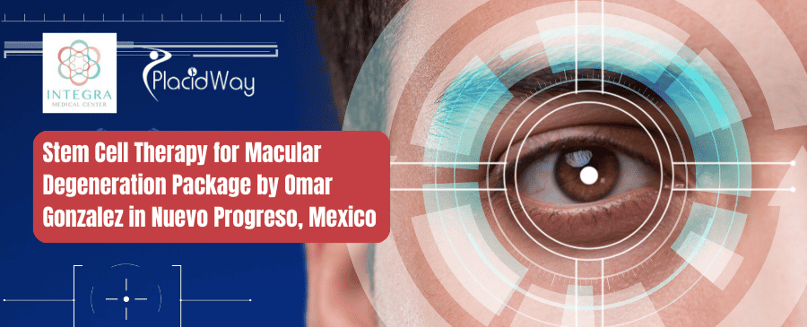 Paquete de Terapia con Células Madre para la Degeneración Macular del Centro Médico Integra en Nuevo Progreso, México