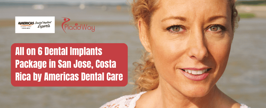 Paquete de implantes dentales All on 6 en San José, Costa Rica de Americas Dental Care