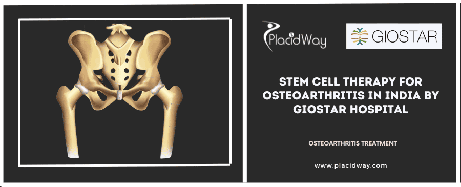 Stem Cell Therapy for Osteoarthritis in India at GIOSTAR Hospital
