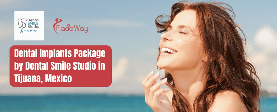 Paquete de implantes dentales de Dental Smile Studio en Tijuana, México
