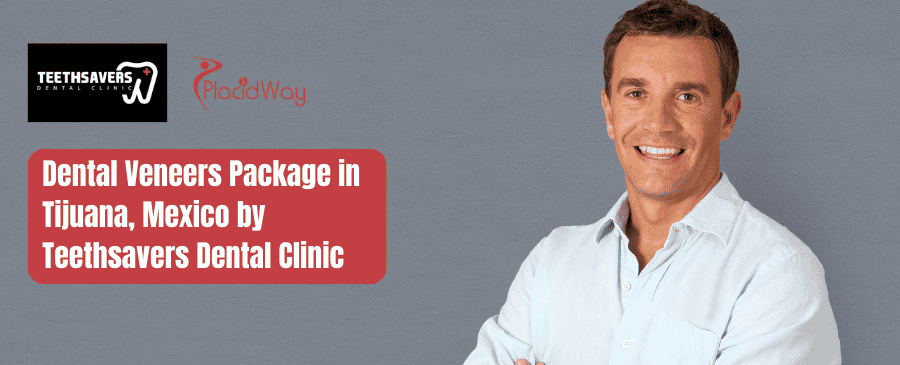 Paquete de carillas dentales de la Clínica Dental Teethsavers en Tijuana, México