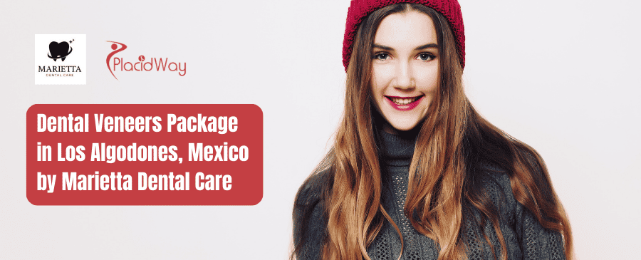 Paquete de Carillas Dentales Marietta en Los Algodones, México