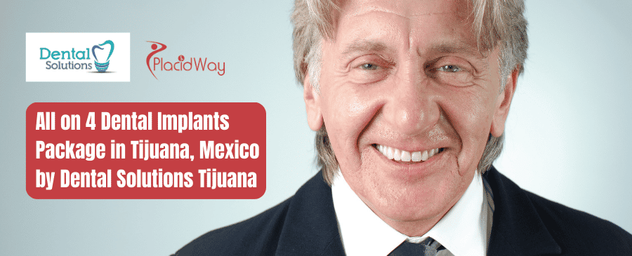 Paquete de implantes dentales All on 4 en Tijuana, México de Dental Solutions Tijuana
