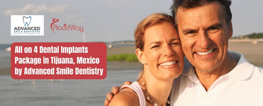 All on 4 Dental Implants Package in Tijuana, Mexico by Advanced Smile Dentistry