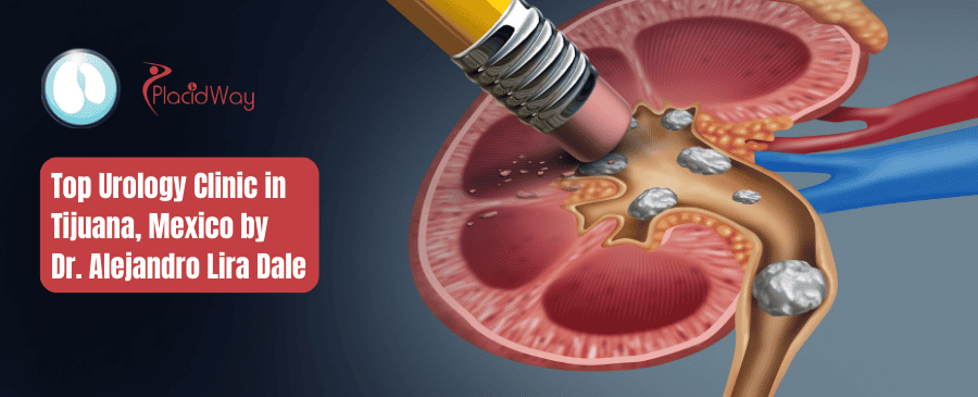 Dr. Alejandro Lira Dale - Clínica de Urología en Tijuana, México