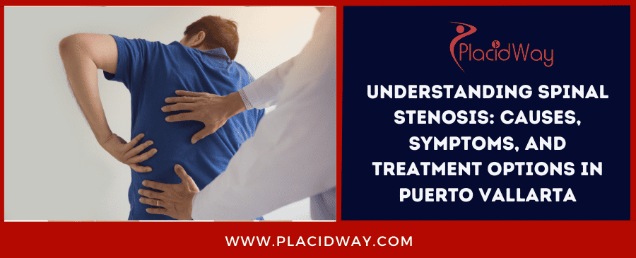Understanding Spinal Stenosis Causes, Symptoms, And Treatment Options In Puerto Vallarta