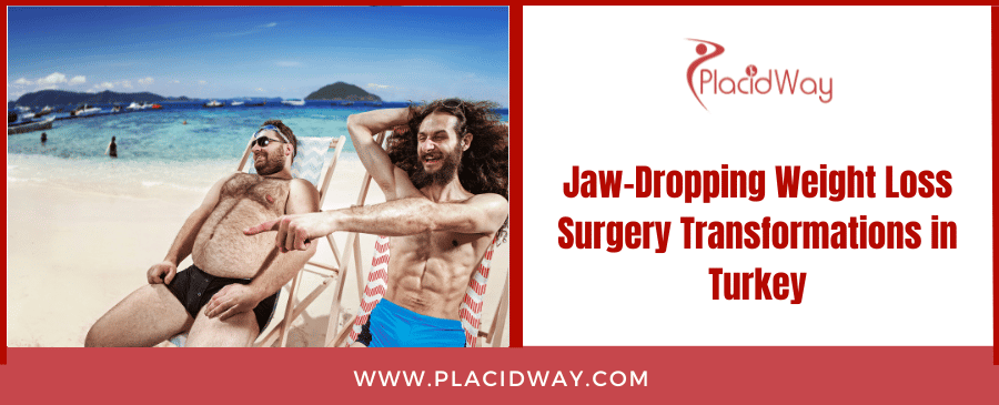 Jaw Dropping Weight Loss Surgery Transformations In Turkey