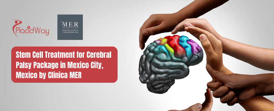 Paquete de tratamiento con células madre para parálisis cerebral en Cancún, México por Clínica MER