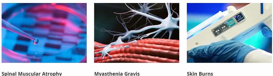 GIOSTAR Hospital Bengaluru India FAQs - SMA, Skin Burns