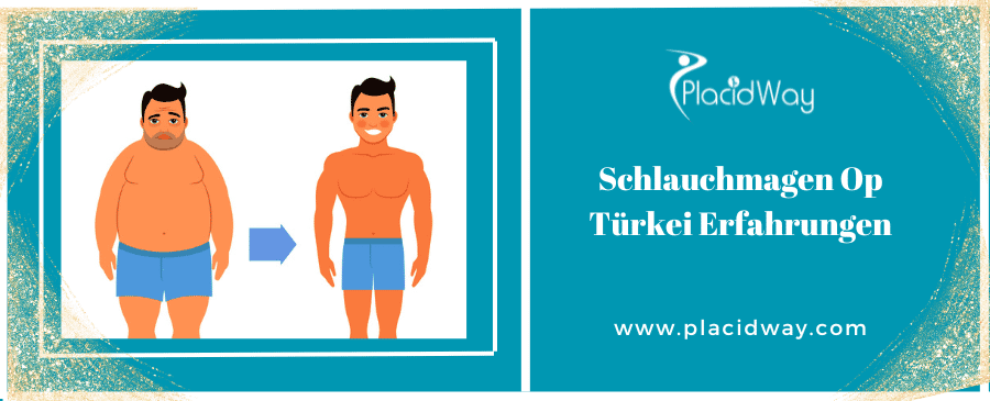 Schlauchmagen Op Türkei Erfahrungen