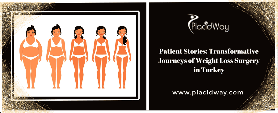 Patient Stories Transformative Journeys Of Weight Loss Surgery In Turkey