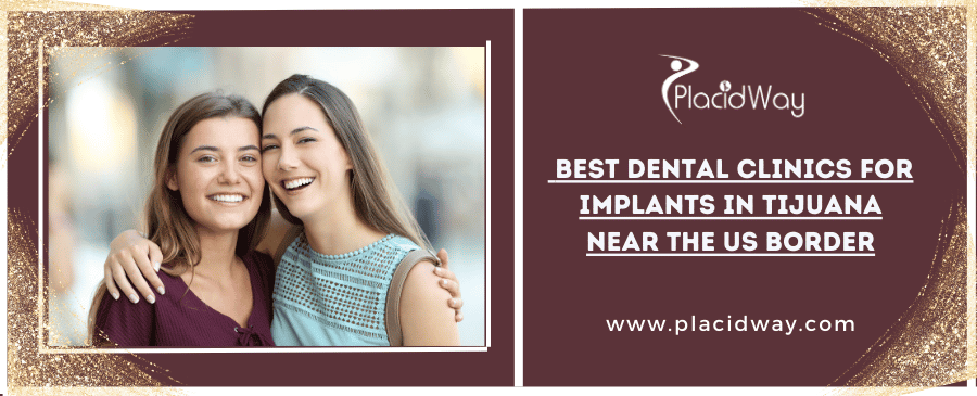 Best Dental Clinics For Implants In Tijuana Near The Us Border