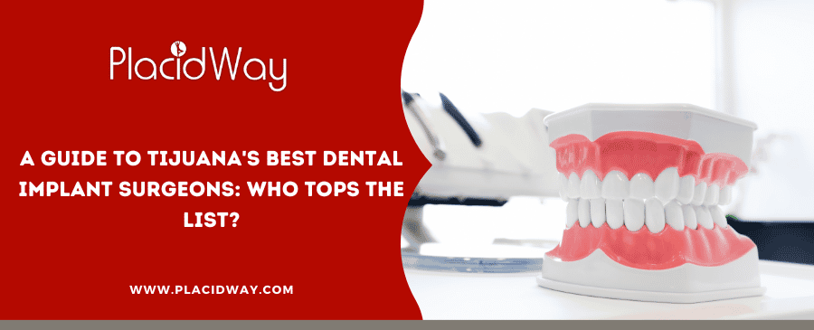 A Guide To Tijuanas Best Dental Implant Surgeons Who Tops The List