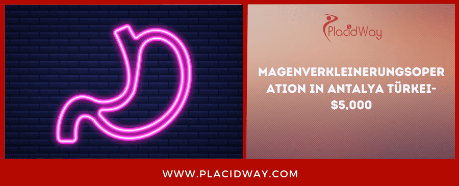 Magenverkleinerungsoperation In Antalya Türkei  $,