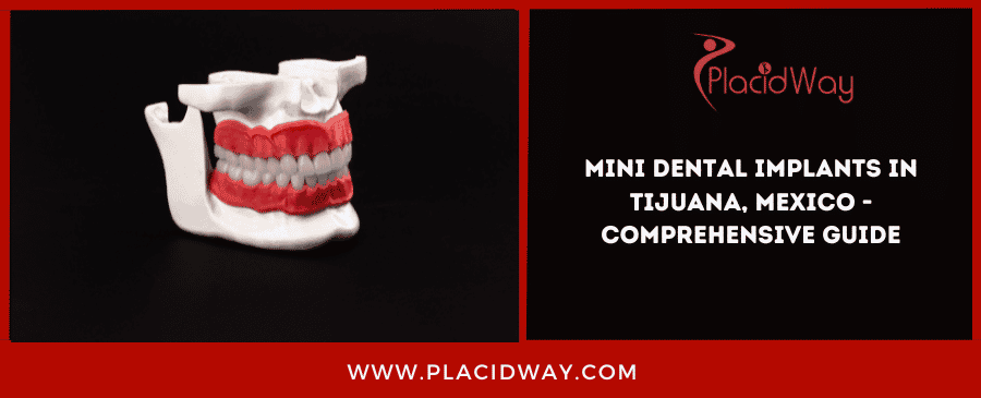 Mini Dental Implants In Tijuana, Mexico