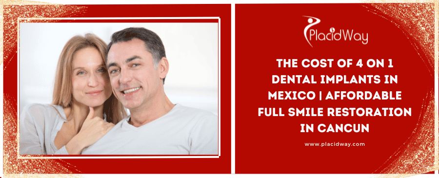 The Cost Of On Dental Implants In Mexico Affordable Full Smile Restoration In Cancun