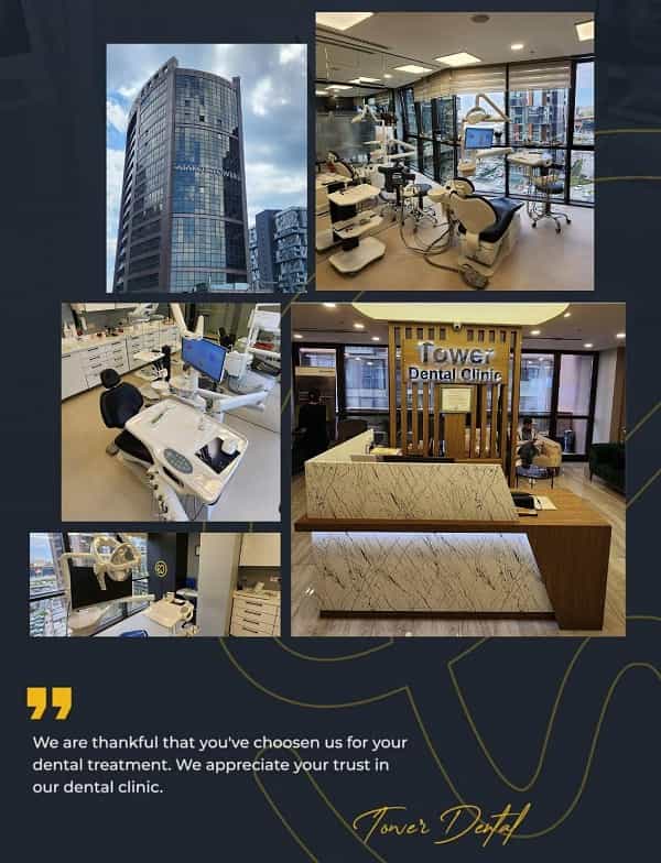 Overview of the All on 4 Dental Implants