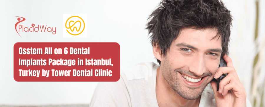 باقة زراعة الأسنان Osstem All on 6 في إسطنبول، تركيا بواسطة عيادة تاور للأسنان