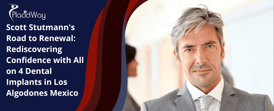 Redescubriendo la confianza con los implantes dentales All on 4 en Los Algodones