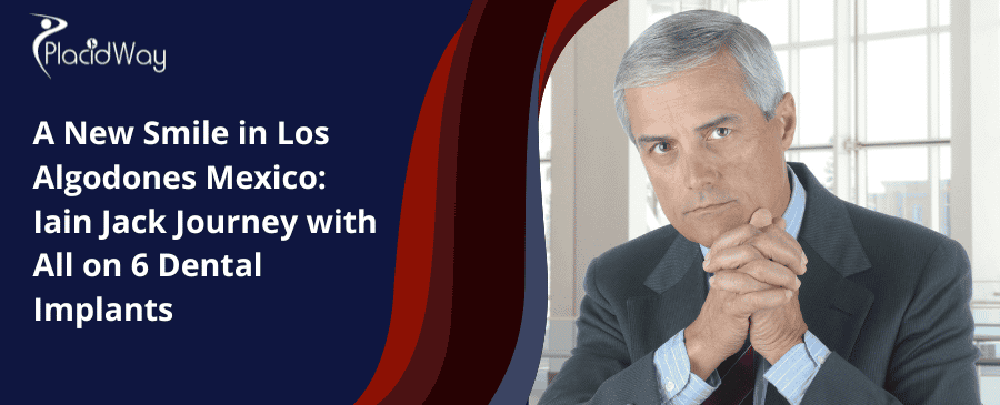 El viaje de Iain Jack con implantes dentales All on 6