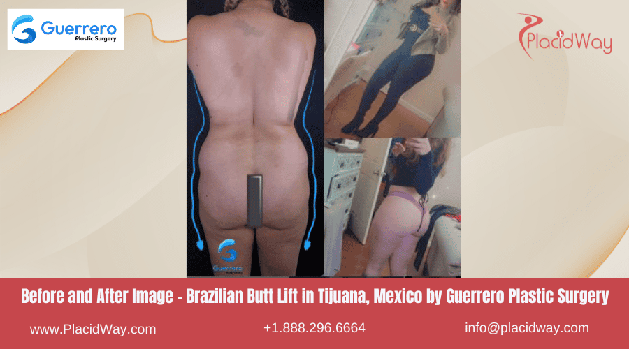 Bbl In Tijuana Mexico Guerrero