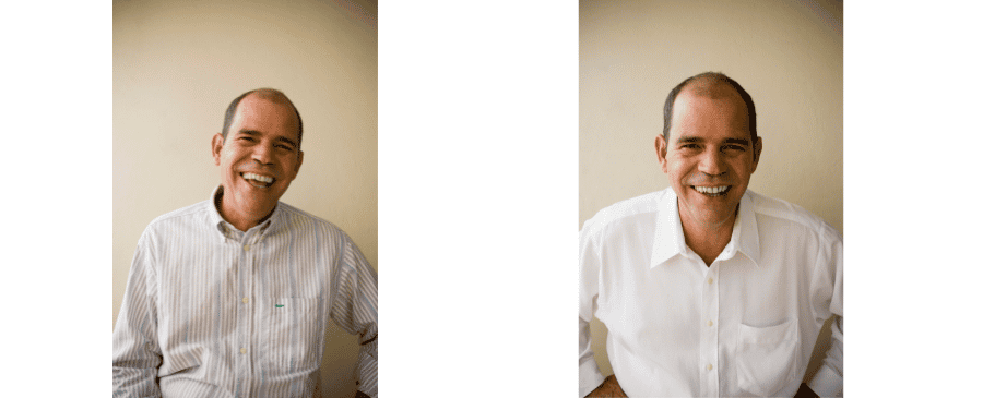 Jamie Smile Restoration with All on 4 Dental Implants in Mexico