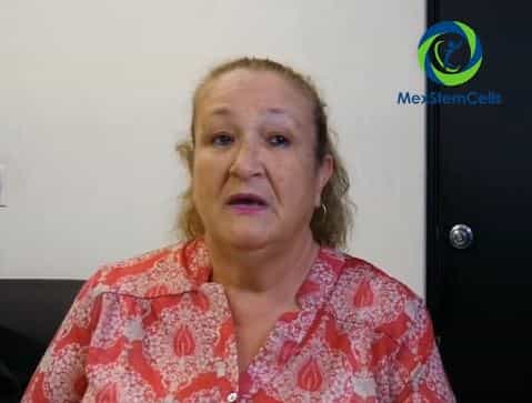 MexStemCells - Células madre para la reparación del cartílago en la Ciudad de México