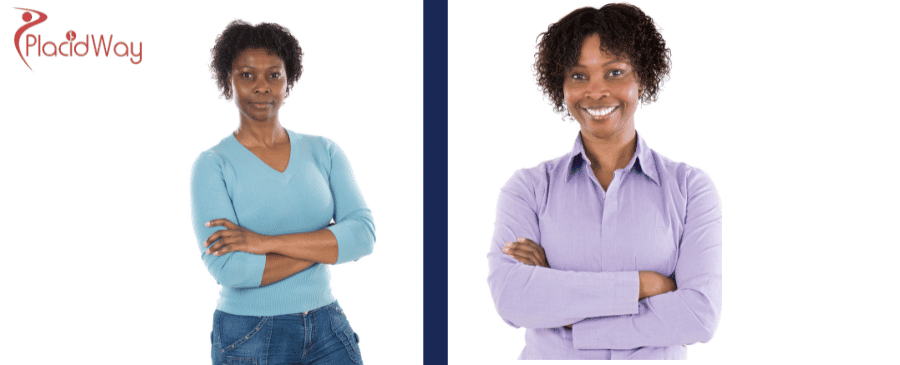 Recuperación de la movilidad con cirugía de reemplazo de rodilla en Turquía