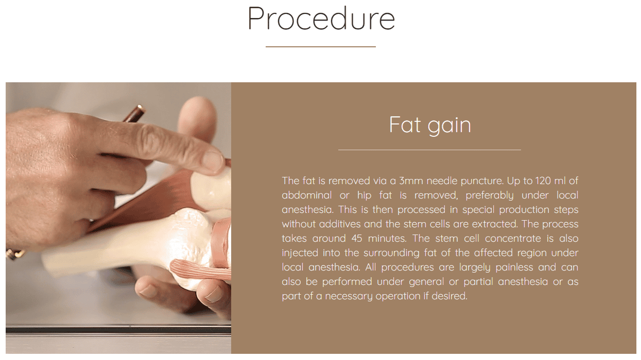 الخلايا الجذعية في دبي