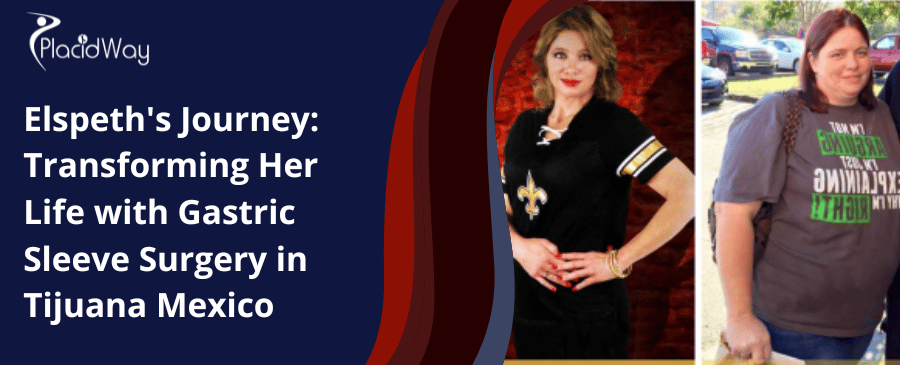 El viaje de Elspeth: transformando su vida con la cirugía de manga gástrica en Tijuana, México