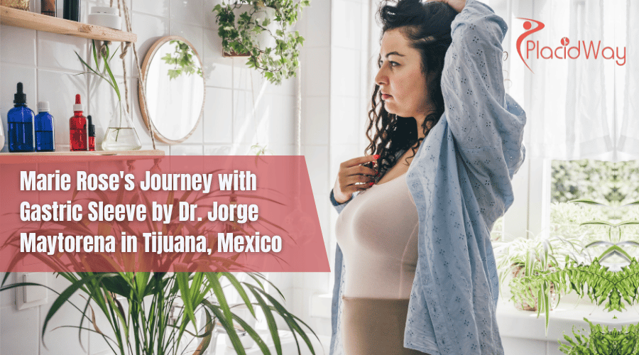 Manga Gástrica en Tijuana México por Maytorena - Marie Story