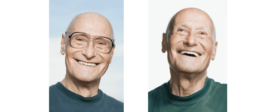 Jake Kalik: viaje hacia una nueva sonrisa con restauración completa de la boca