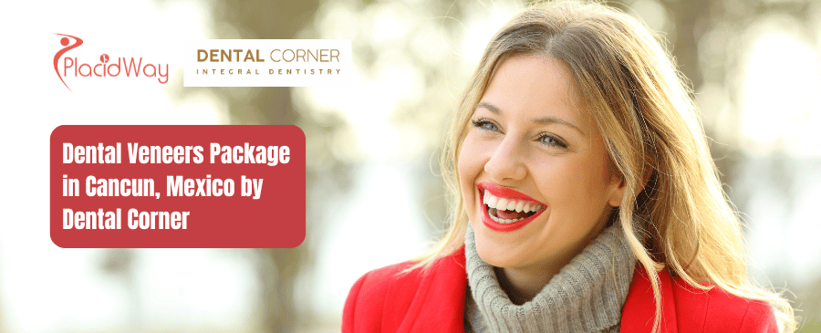 Paquete de carillas dentales en Cancún, México de Dental Corner