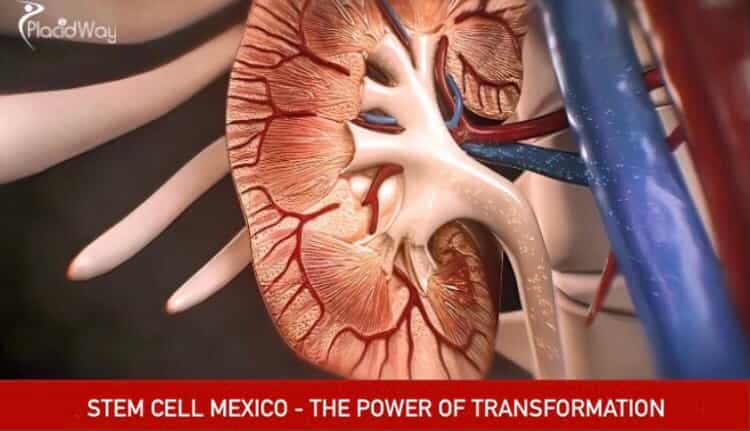 salud de las plantas madre en México