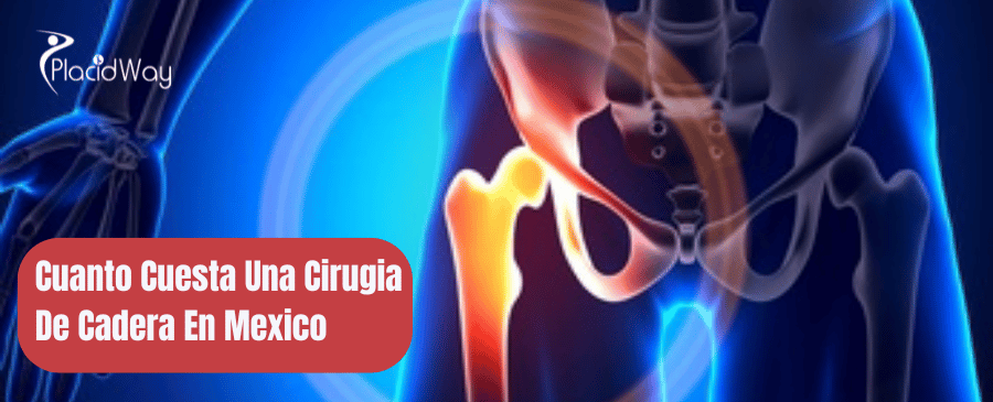 Cuanto Cuesta Una Cirugia De Cadera En Mexico