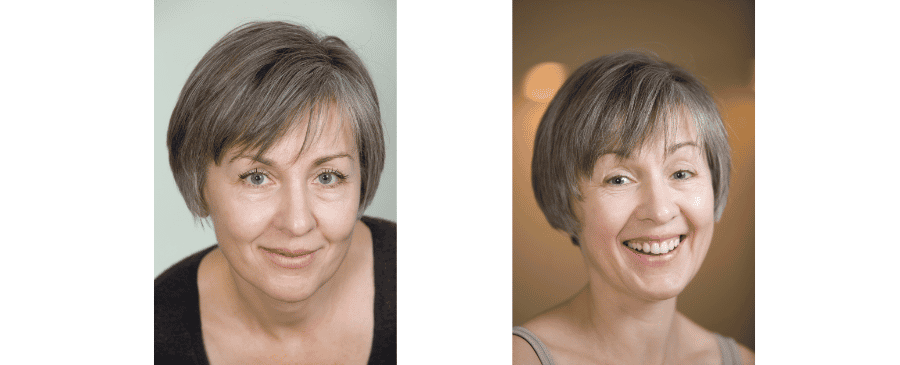 De la desesperación al bienestar: el tratamiento transformador con células madre de Diana para los pulmones en México