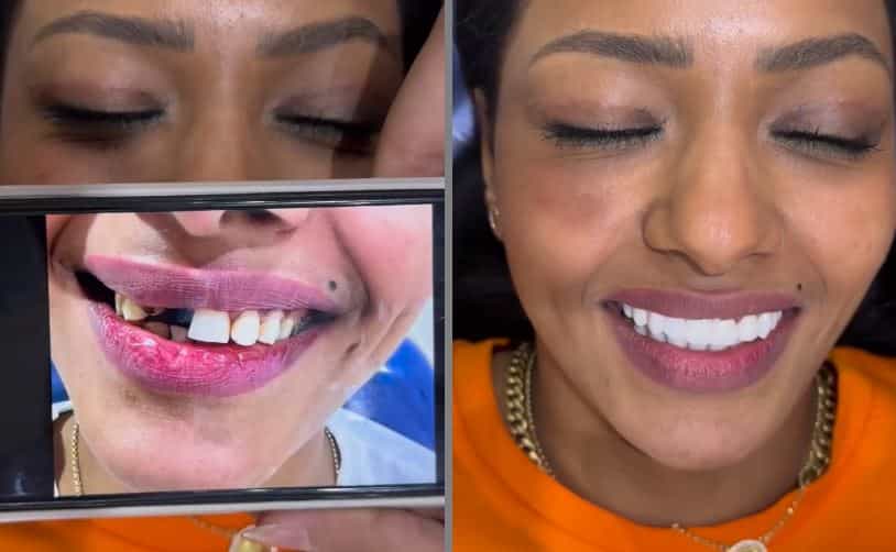 Zahnimplantate in Kairo, Ägypten