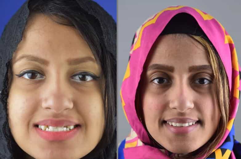 Zahnspangenbehandlung in Kairo, Ägypten – Patientengeschichte