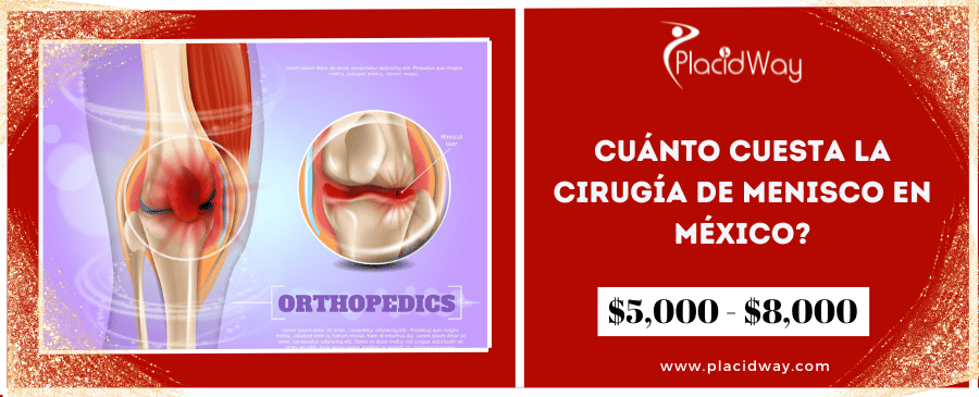 Cuánto Cuesta La Cirugía De Menisco En México