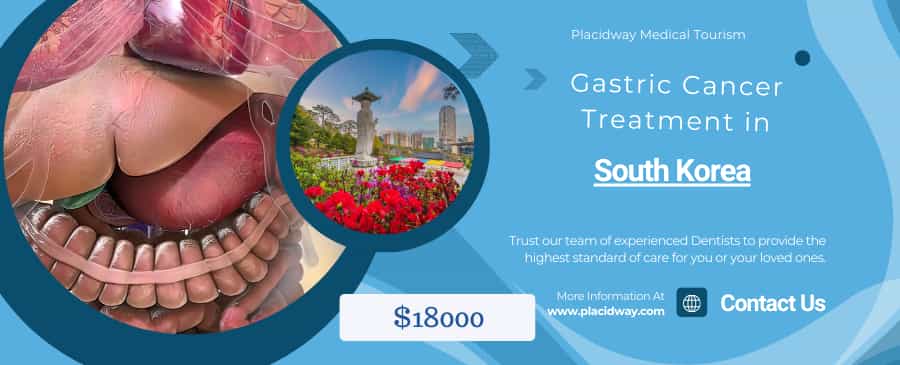 Gastric Cancer Treatment in South Korea Gastric Cancer Treatment in South Korea
