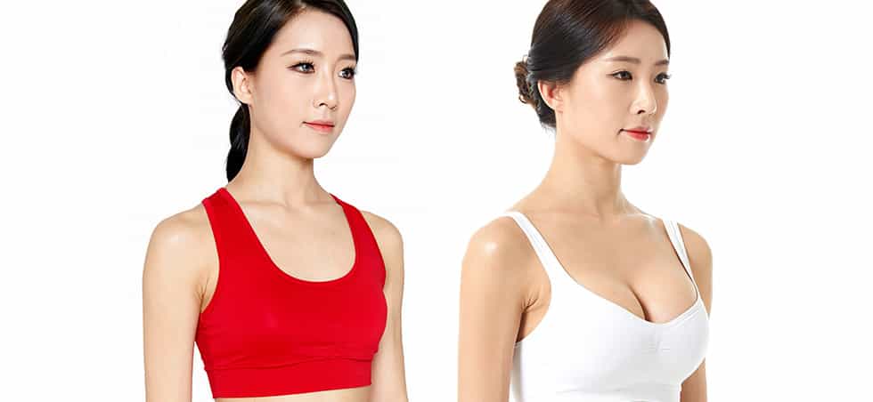 Before and After of Body Surgery in Seoul, South Korea