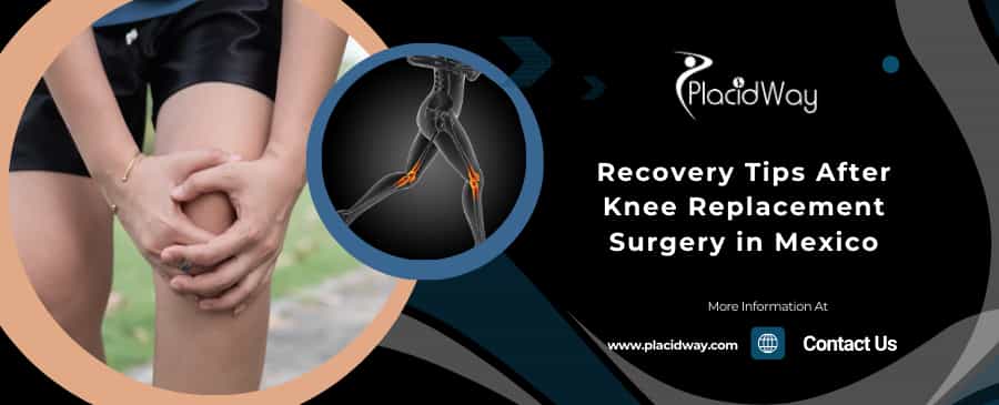 Recovery Tips After Knee Replacement Surgery In Puerto Vallarta