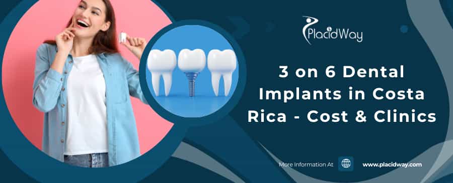 A graphic illustrating dental implants, with text 'Dental Implants Cost in Costa Rica'