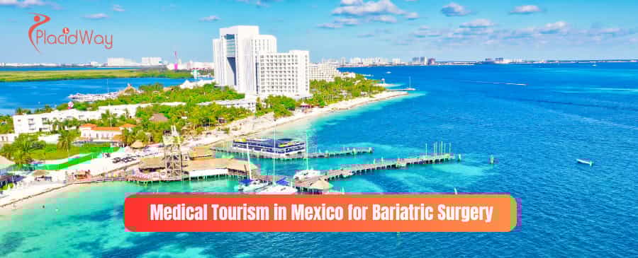 Cirugía de obesidad en Mérida, México