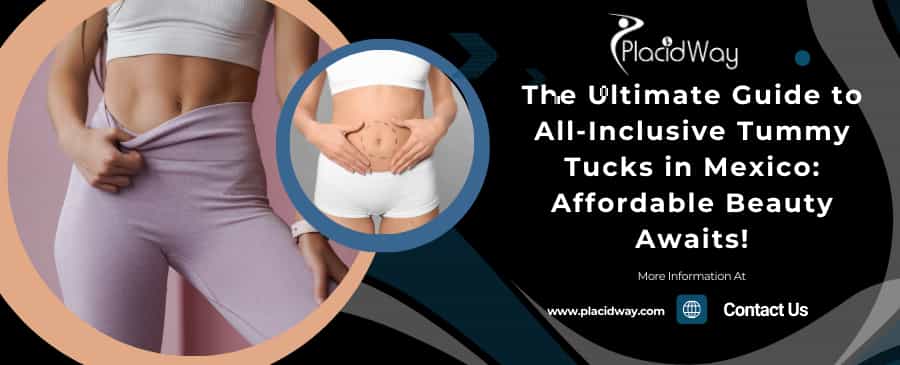 The Ultimate Guide To All Inclusive Tummy Tucks In Mexico Affordable Beauty Awaits!