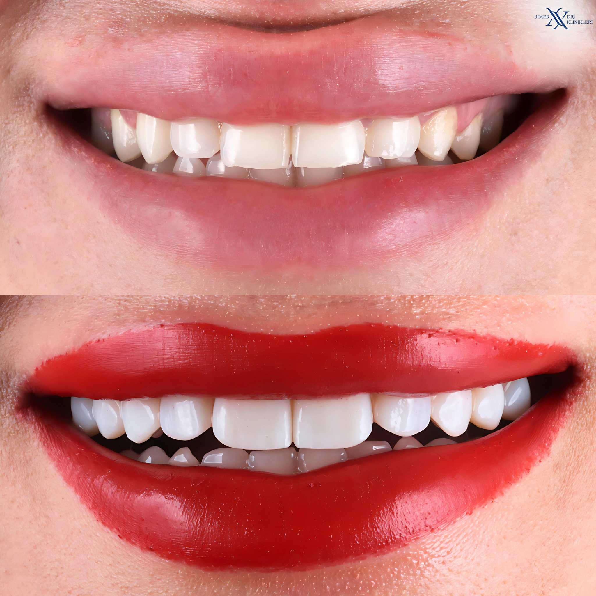 Clínicas dentales Jimer en Bursa, Turquía